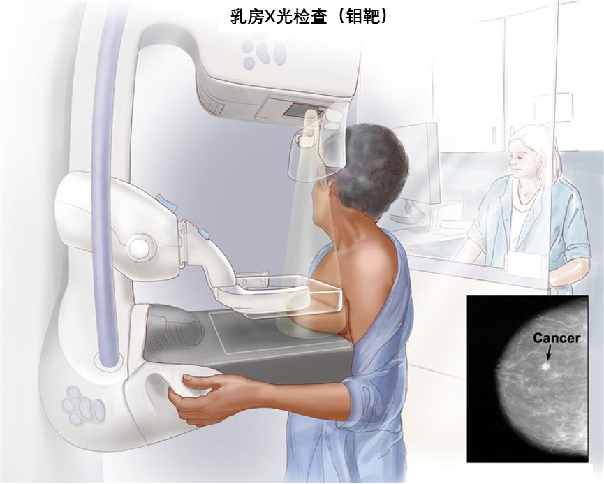 乳房X光检查应该了解什么？