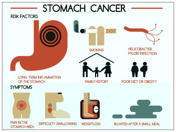 胃癌相关的主要统计学数据
