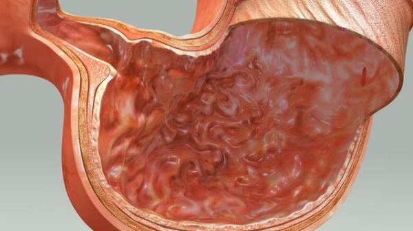胃癌后期吐的黑色东西 胃癌后期吐血生存期大约多长？